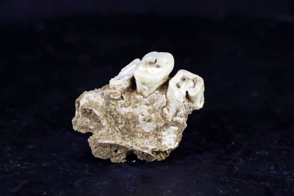Prehistoric Foragers Likely Used Psychoactive Betel Nuts for Pain Relief Millennia Earlier Than Previously Thought